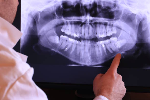Best Broken or Cracked Tooth Emergency Dentist in Lawai, HI
