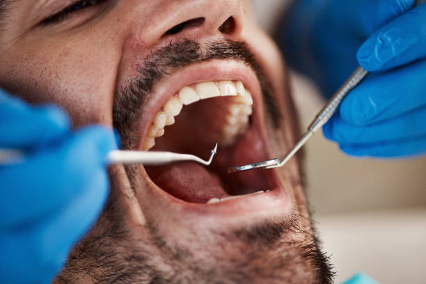 Best Emergency Dental Care for Abscessed Tooth in Lawai, HI