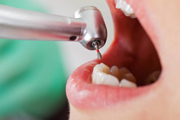 Best Urgent Dental Care for Toothache in Lawai, HI
